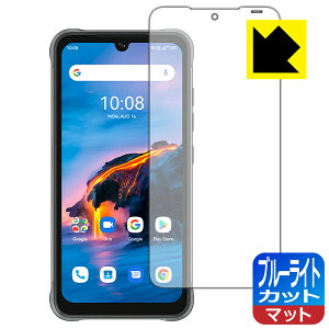 u[CgJbgy ˒ጸ zیtB UMIDIGI BISON Pro { А