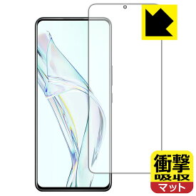 衝撃吸収【 反射低減 】保護フィルム ZTE Axon 30 (前面のみ)【 指紋認証対応 】 日本製 自社製造直販