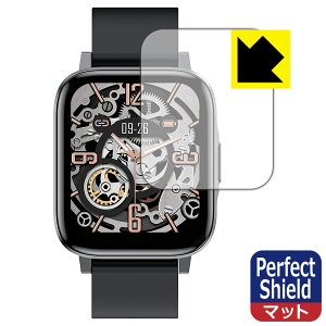 Perfect Shield FIPRIN Smart Watch 7044 F60 (3Zbg) { А