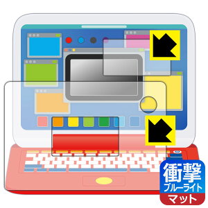 |P sJbƃAJf~[ }EXŃQbgp\R p Ռzy u[CgJbg z˒ጸ یtB (ʗp/ӂp 2g) { А