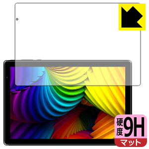 9H���d�x�y ���˒ጸ �z�ی�t�B���� IRIE 10.1�C���`�^�u���b�g FFF-TAB10A3 ���{�� ���А�������