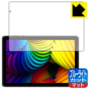 �u���[���C�g�J�b�g�y ���˒ጸ �z�ی�t�B���� IRIE 10.1�C���`�^�u���b�g FFF-TAB10A3 ���{�� ���А�������