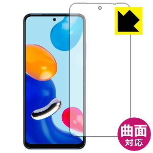 Flexible Shieldy  zیtB Xiaomi Redmi Note 11S / Redmi Note 11 (Oʂ̂) { А