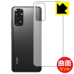 Flexible Shield Mattey ˒ጸ zیtB Xiaomi Redmi Note 11S / Redmi Note 11 (wʂ̂) { А