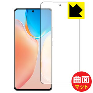 Flexible Shield Matte�y ���˒ጸ �z�ی�t�B���� vivo X70 Pro ���{�� ���А�������