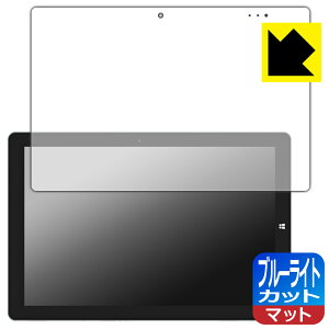 �u���[���C�g�J�b�g�y ���˒ጸ �z�ی�t�B���� Teclast X11 ���{�� ���А�������