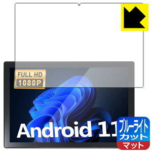 �u���[���C�g�J�b�g�y ���˒ጸ �z�ی�t�B���� Plimpton PlimPad P50 ���{�� ���А�������