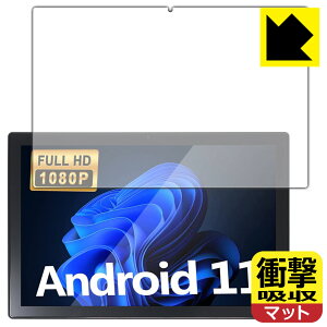 �Ռ��z���y ���˒ጸ �z�ی�t�B���� Plimpton PlimPad P50 ���{�� ���А�������