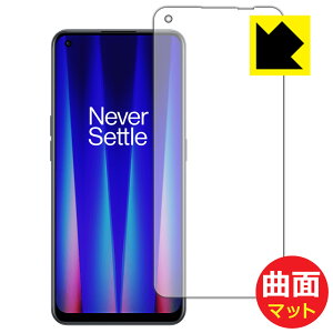Flexible Shield Mattey ˒ጸ zیtB OnePlus Nord CE 2 5G (Oʂ̂) { А