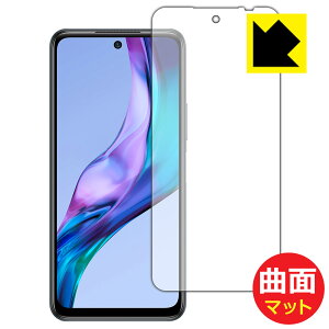 Flexible Shield Mattey ˒ጸ zیtB Xiaomi Redmi Note 10T (Oʂ̂) { А