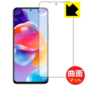 Flexible Shield Mattey ˒ጸ zیtB Xiaomi Redmi Note 11 Pro+ 5G (Oʂ̂) { А