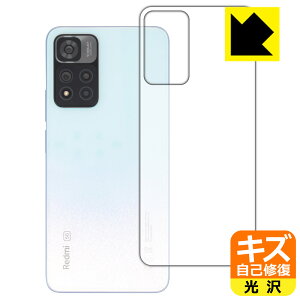 LYȏCیtB Xiaomi Redmi Note 11 Pro+ 5G (wʂ̂) { А