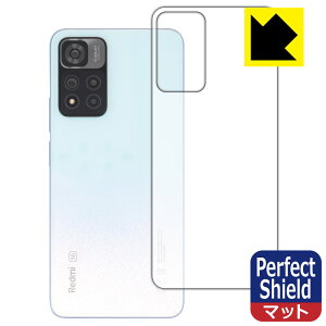 Perfect Shieldy ˒ጸ zیtB Xiaomi Redmi Note 11 Pro+ 5G (wʂ̂) { А