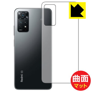 Flexible Shield Mattey ˒ጸ zیtB Xiaomi Redmi Note 11 Pro 5G / Redmi Note 11 Pro (wʂ̂) { А