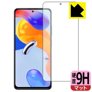 9Hdxy ˒ጸ zیtB Xiaomi Redmi Note 11 Pro 5G / Redmi Note 11 Pro (Oʂ̂) { А