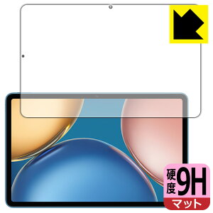 9H���d�x�y ���˒ጸ �z�ی�t�B���� Honor Pad V7 ���{�� ���А�������