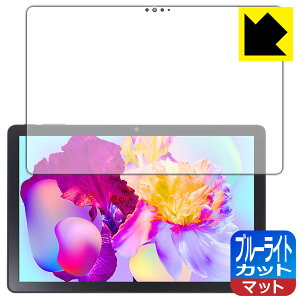�u���[���C�g�J�b�g�y ���˒ጸ �z�ی�t�B���� Teclast P30HD ���{�� ���А�������
