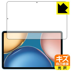 �L�Y���ȏC���ی�t�B���� Honor Pad V7 ���{�� ���А�������