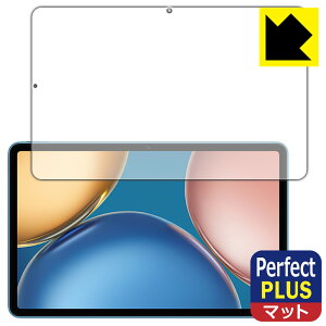 Perfect Shield Plus�y ���˒ጸ �z�ی�t�B���� Honor Pad V7 ���{�� ���А�������
