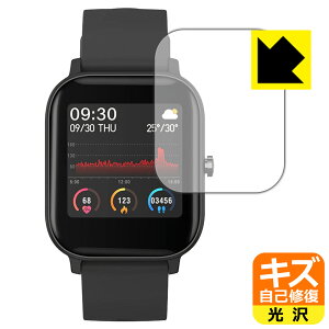 �L�Y���ȏC���ی�t�B���� SMART BAND BARCA SB07 ���{�� ���А�������
