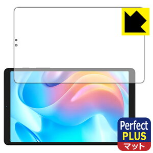 Perfect Shield Plus�y ���˒ጸ �z�ی�t�B���� realme Pad Mini ���{�� ���А�������
