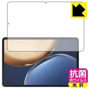 �R�� �R�E�C���X�y ���� �z�ی�t�B���� Honor Pad V7 Pro ���{�� ���А�������