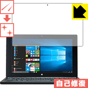 �L�Y���ȏC���ی�t�B���� Diginnos DG-D11IWV�V���[�Y ���{�� ���А�������