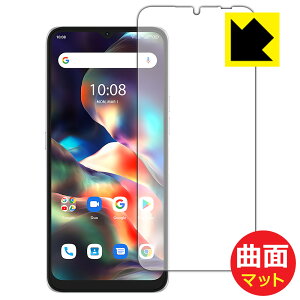 Flexible Shield Mattey ˒ጸ zیtB UMIDIGI F3 Pro 5G { А