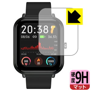 9Hdxy ˒ጸ zیtB X}[gEHb` Q9 PRO y 1.7C`f z / QS15 { А