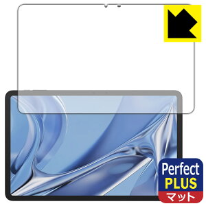 Perfect Shield Plus�y ���˒ጸ �z�ی�t�B���� DOOGEE T20 Ultra ���{�� ���А�������