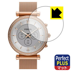 Perfect Shield Plusy ˒ጸ zیtB FOSSIL CARLIE WFl[V6 nCubhX}[gEHb` y P[XTCY 40mmp z { А