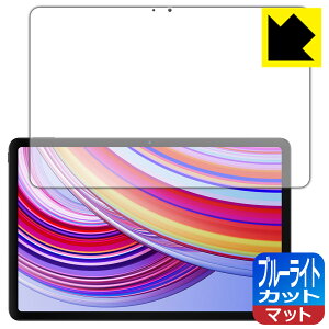 �u���[���C�g�J�b�g�y ���˒ጸ �z�ی�t�B���� Xiaomi Redmi Pad Pro ���{�� ���А�������