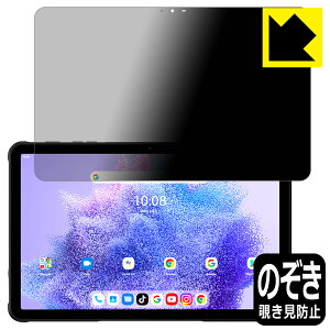 Privacy Shield�y �`�����h�~�E���˒ጸ �z�ی�t�B���� UMIDIGI Active T1 ���{�� ���А�������