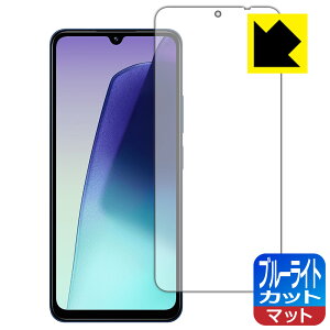 u[CgJbgy ˒ጸ zیtB Xiaomi Redmi 14C { А