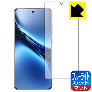 �u���[���C�g�J�b�g�y ���˒ጸ �z�ی�t�B���� vivo X200 Pro �y �w��F�ؑΉ� �z ���{�� ���А�������