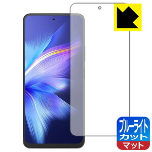 �u���[���C�g�J�b�g�y ���˒ጸ �z�ی�t�B���� Blackview SHARK 9 ���{�� ���А�������