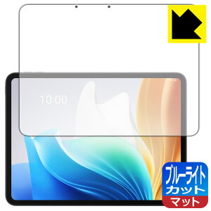 �u���[���C�g�J�b�g�y ���˒ጸ �z�ی�t�B���� OPPO Pad Neo ���{�� ���А�������