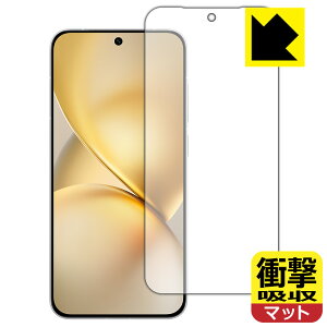 �Ռ��z���y ���˒ጸ �z�ی�t�B���� vivo X200 Pro mini (��ʗp)�y �w��F�ؑΉ� �z ���{�� ���А�������