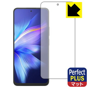 Perfect Shield Plus�y ���˒ጸ �z�ی�t�B���� Blackview SHARK 9 (��ʗp) ���{�� ���А�������
