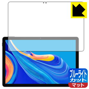 u[CgJbgy ˒ጸ zیtB DOOGEE U11 { А