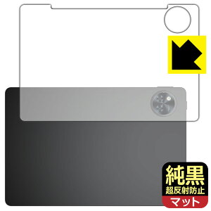 NAy ˖h~ zیtB DOOGEE U11 (wʗp) { А