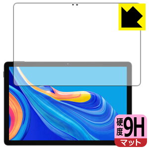 9Hdxy ˒ጸ zیtB DOOGEE U11 (ʗp) { А