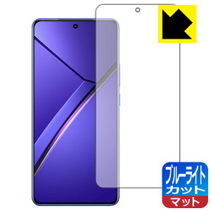 �u���[���C�g�J�b�g�y ���˒ጸ �z�ی�t�B���� realme Neo 7 �y �w��F�ؑΉ� �z ���{�� ���А�������