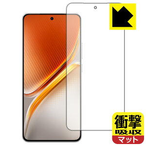 �Ռ��z���y ���˒ጸ �z�ی�t�B���� vivo iQOO Neo10 / iQOO Neo10 Pro �y �w��F�ؑΉ� �z ���{�� ���А�������