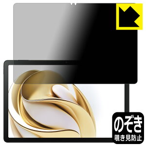 Privacy Shield�y �`�����h�~�E���˒ጸ �z�ی�t�B���� nubia Pad SE ���{�� ���А�������