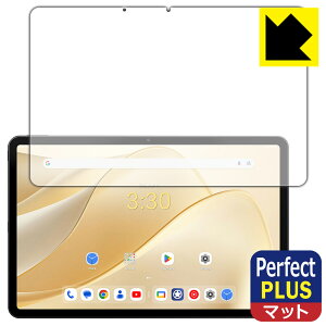Perfect Shield Plusy ˒ጸ zیtB ALLDOCUBE iPlay 70 Pro (ʗp) { А