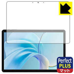 Perfect Shield Plusy ˒ጸ zیtB CHUWI Hi10 X1 { А