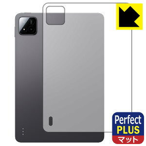 Perfect Shield Plusy ˒ጸ zیtB Xiaomi Pad 7 / Xiaomi Pad 7 Pro (11.2C`) wʗp { А