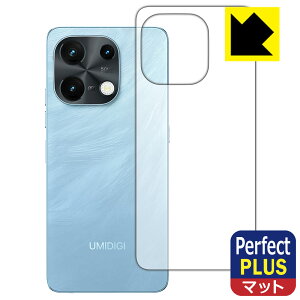 Perfect Shield Plusy ˒ጸ zیtB UMIDIGI Note 100 5G (wʗp) { А