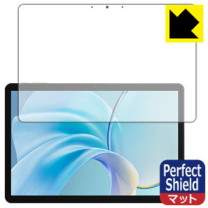 Perfect Shieldy ˒ጸ zیtB CHUWI Hi10 X1 { А